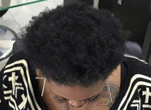 Load image into Gallery viewer, Dry Hair Loss Prevention Complete System