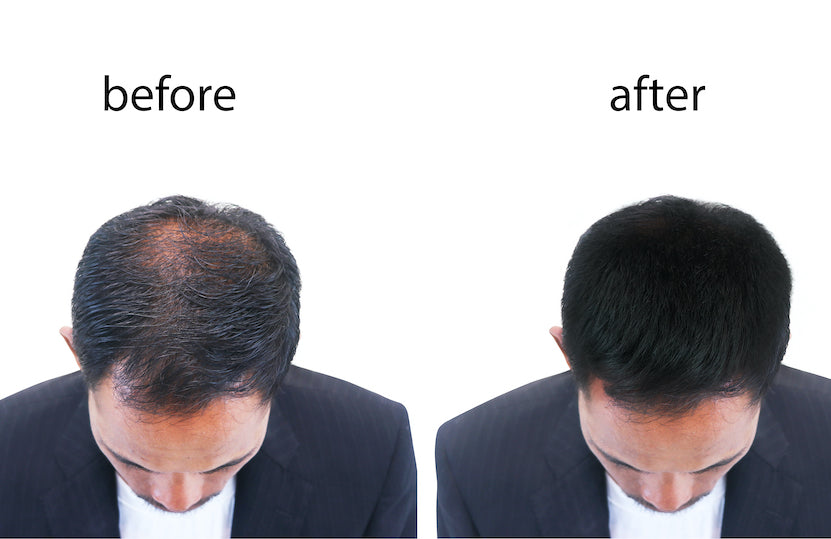 Organic Hair Loss Prevention