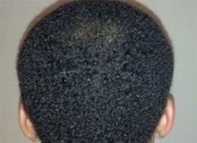 Load image into Gallery viewer, Dry Hair Loss 4oz. Prevention Treatment Spray

